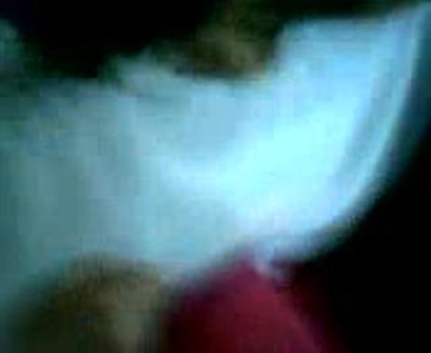 Massage a la Ness