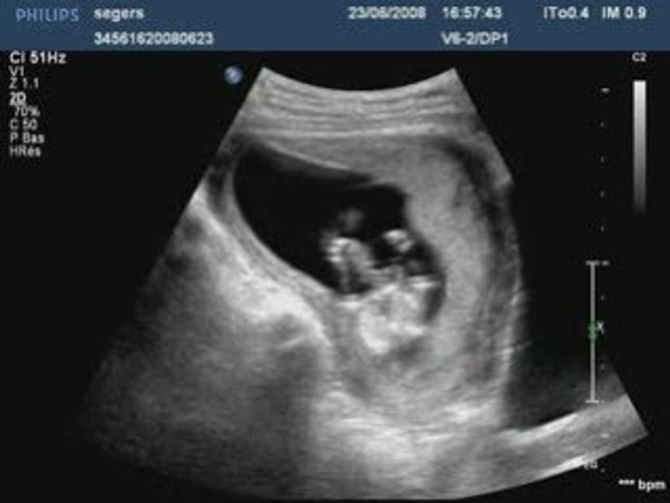 aurelie son bébé jtd soeurette :p