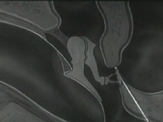 How the ear works, 1940