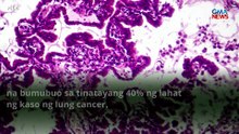 Pope Leo, may lung cancer; sumailalim sa operasyon | GMA News Feed