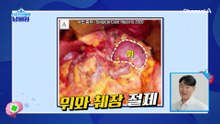 위의 일부를 절제해야 한다?! 소리 없이 찾아오는 위암