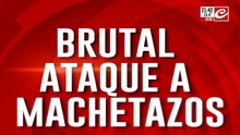 ¡Baño de sangre en Carlos Paz! Lo masacraron a machetazos y pelea por su vida