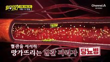 [예고] 당뇨병 때문에 머리에도 문제가 생겼다?! 공복혈당 잡는 데 도움 준 이것의 정체는?