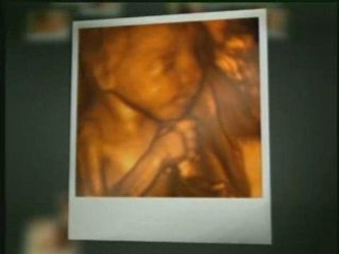 Prenatal Impressions Pregnancy Spa & 3D/4D Ultrasound Center