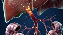 What Happens to Oral Medicine in Your Liver? | First-Pass Metabolism