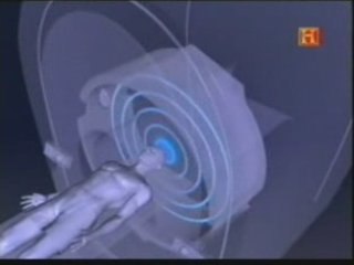 Resonancia magnetica