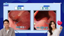 암이 될 수 있는 선종? 장가현의 몸에서 확인한 거대 용종의 정체는?