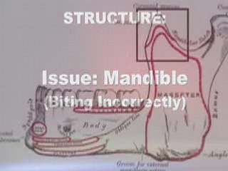 Overcoming Fibromyalgia