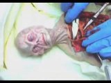 Alien Autopsy Secrets Revealed