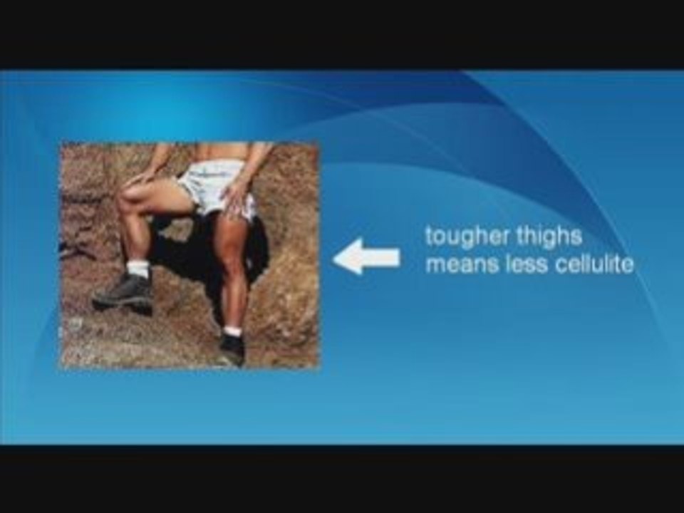 Cellulite Removal