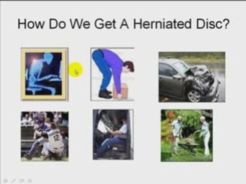 Herniated disc treatment and causes in scottsdale arizona.