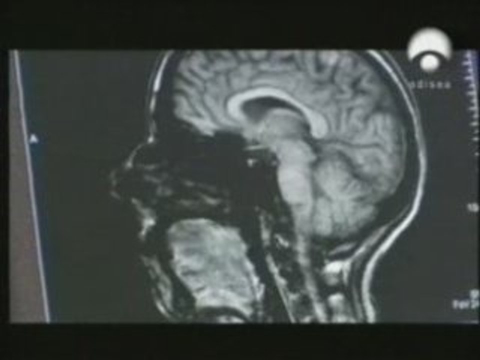 Memoria emocional: Diferencias de genero