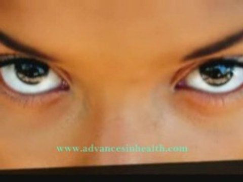 Sotretinoin treatment for cystic acne