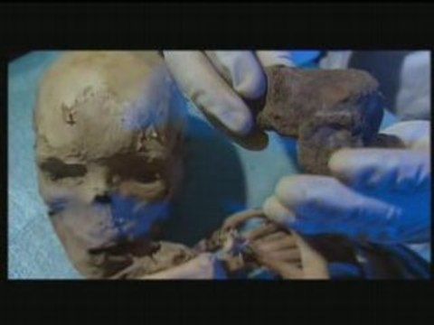 La fabuleuse Histoire des excréments (1/3)