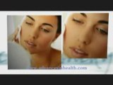 Acne care problems and medical steroid use