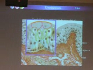 cellules pseudostratifiées, urothélium