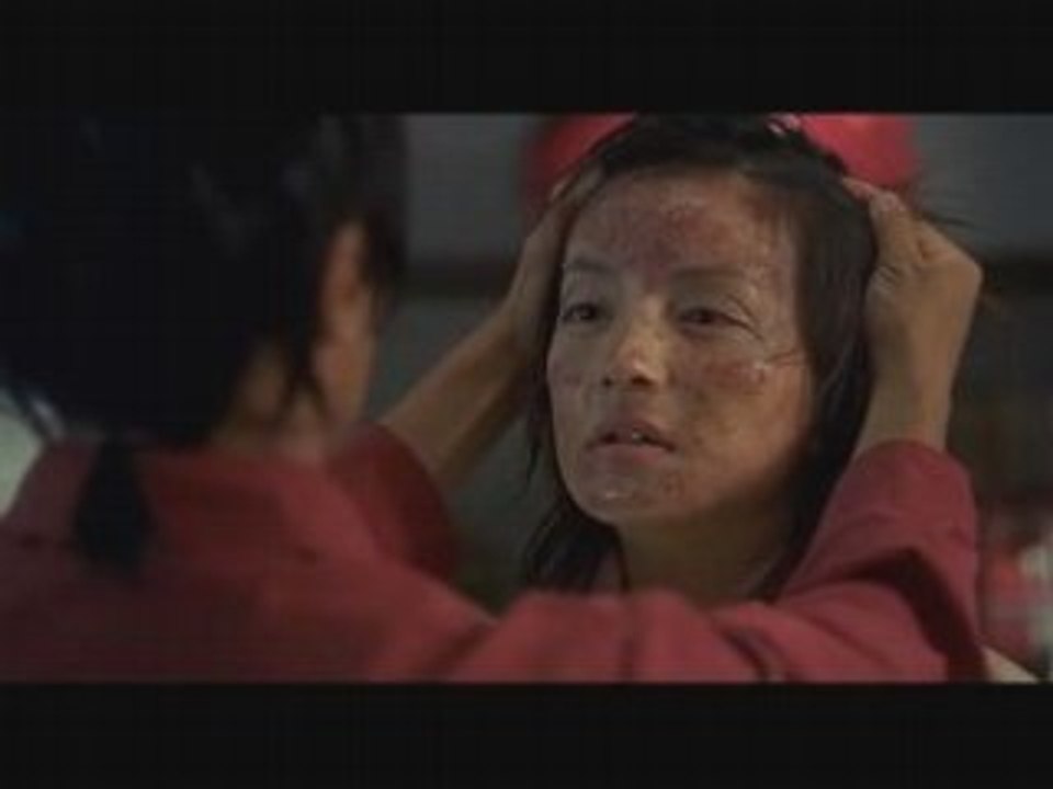 Pedro Boutons D'acné