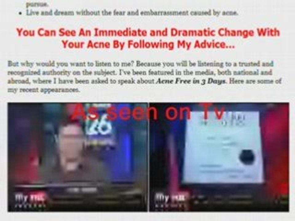 Acne | Acne free in 3 days guara