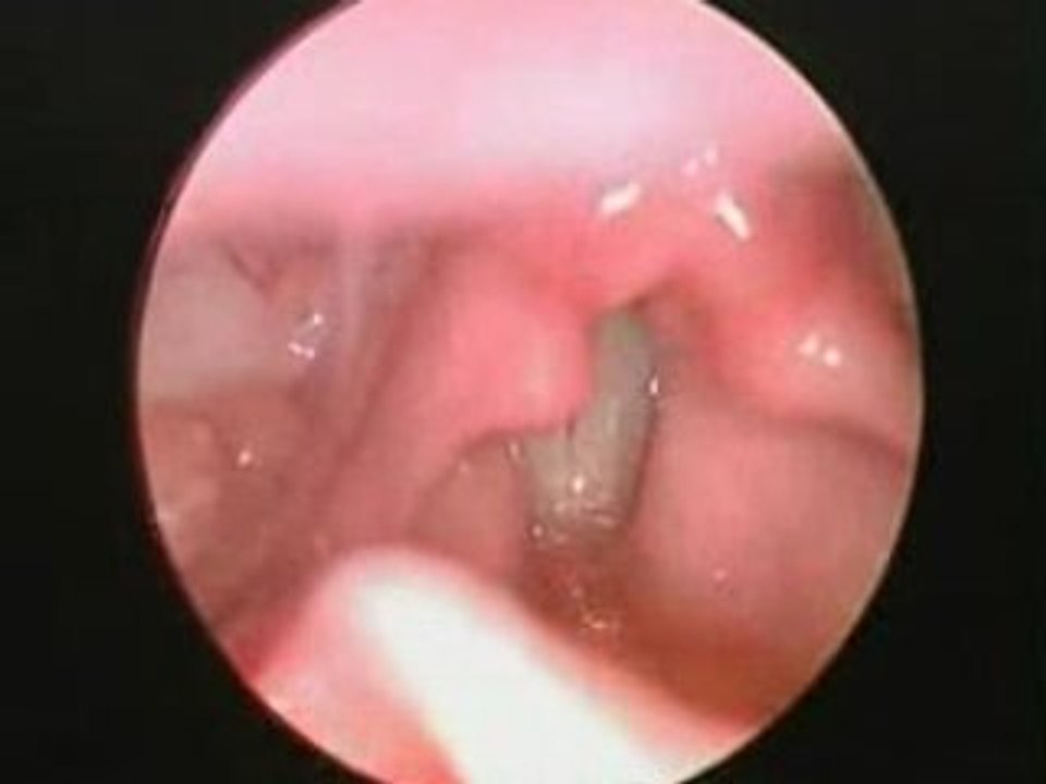 Vocal Health ses teli