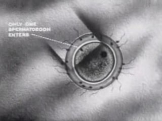 Rabbit Vivisection: Old Biology Life Science Movie Vintage