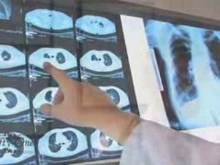 Electronic Cigarette smoke 51