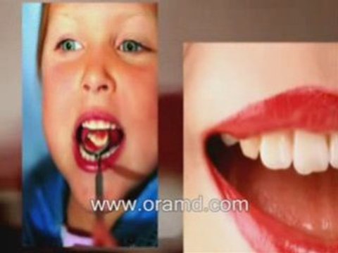 Halitosis and anaerobic bacteria lead to periodontal disease