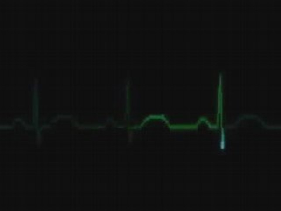 Rapimenti Alieni ( Corrado Malanga ) - PARTE 1