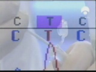 Sindrome de fase de sueño avanzada