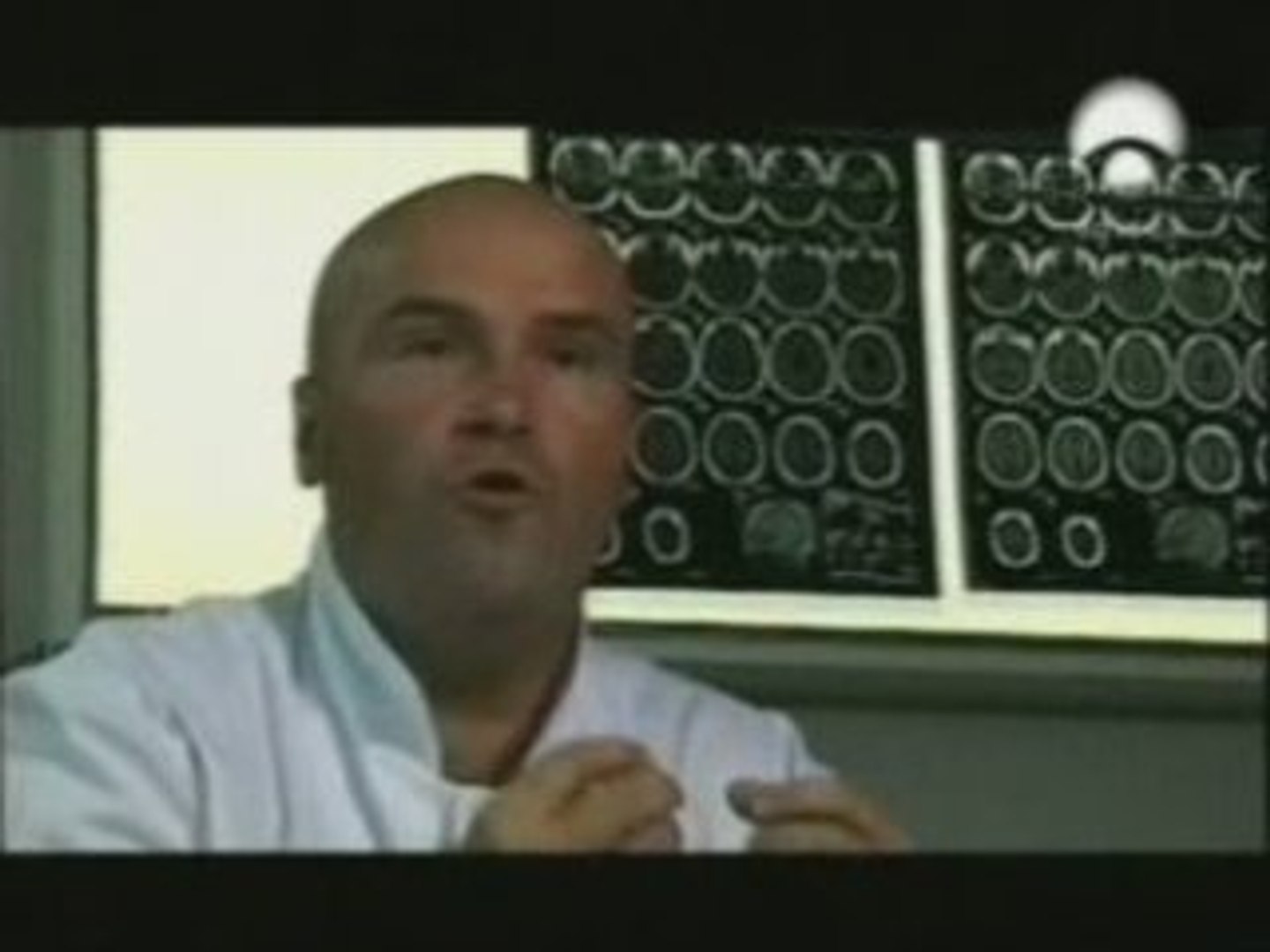 Cannabis y esquizofrenia
