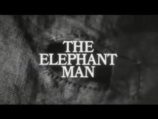 BANDE ANNONCE 1 THE ELEPHANT MAN STEFGAMERS