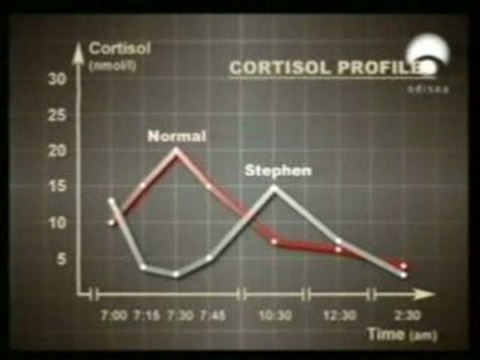 Corazon: Factores de riesgo