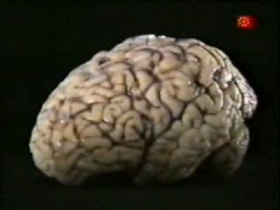 Cerebro y riesgo