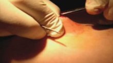 Operation