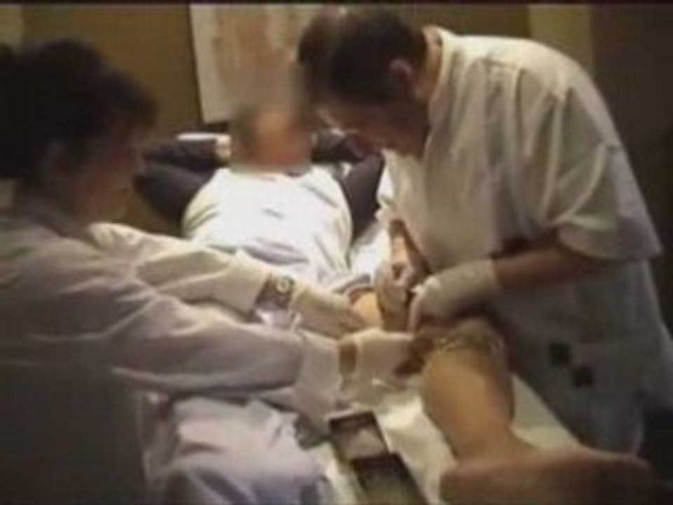 Se débarrasser de ses Varices
