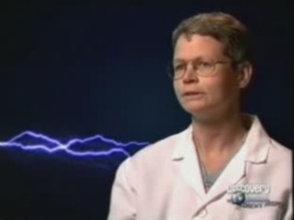 Epilepsia farmacorresistente