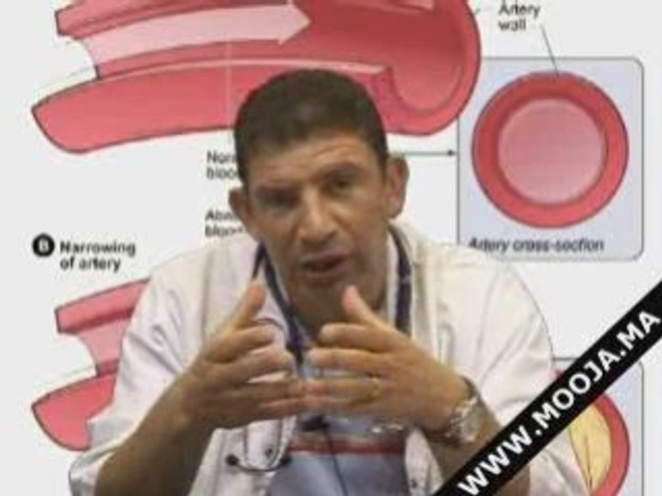 Mooja(Maroc): Definition cardiologie