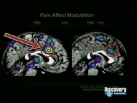 Efecto placebo: El toque curativo