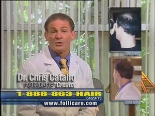 Follicare Hair Growth Product to Fight Hair Loss