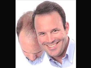 One of the best Hair Loss Remedies out there!
