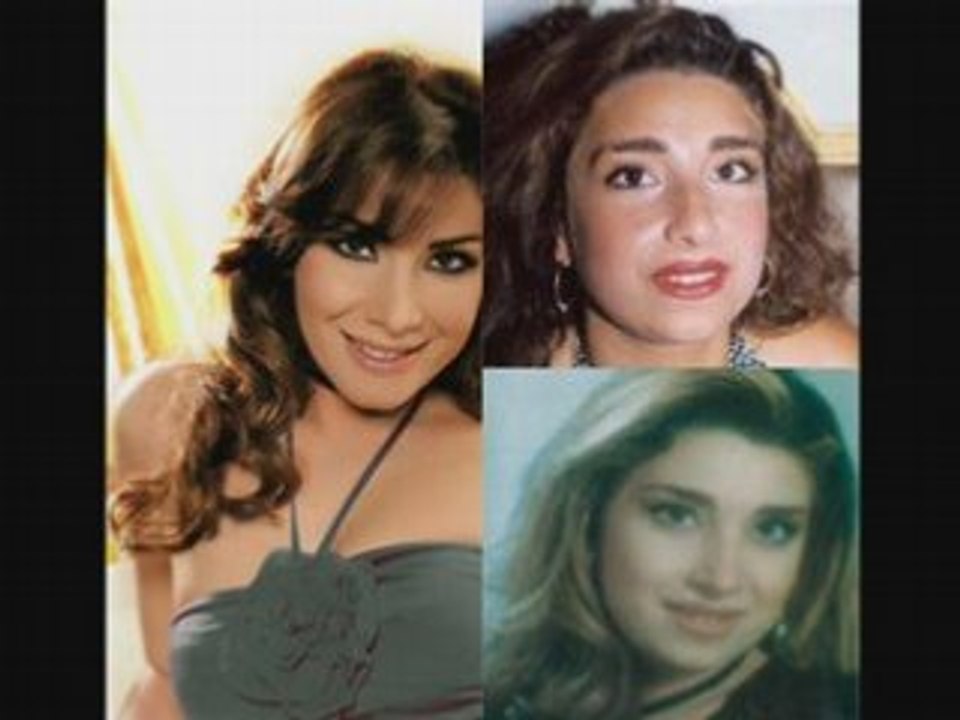 فنانين قبل و بعد التجميل