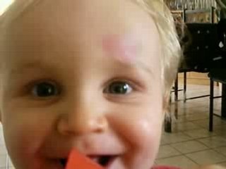 081018 - thibault et son bobo au front