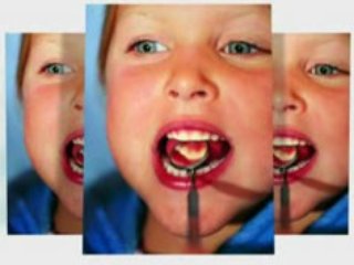 Cosmetic Teeth Whitening For A Bright Smile