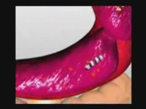 Systemic Enzymes for fibroid reduction.