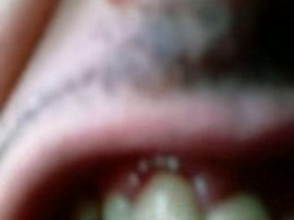 Epinal rivoli nico 88