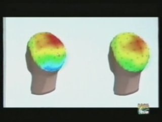 Fibromialgia: Neuropsicologia