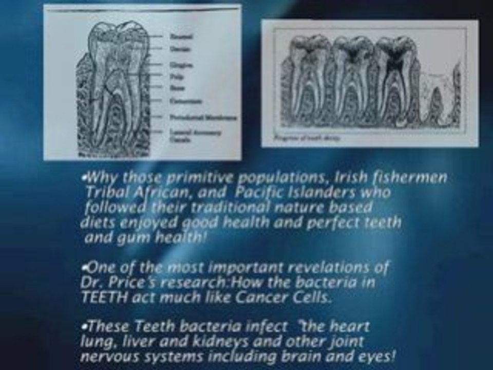 gum disease pictures,treating gum disease in Los Angeles