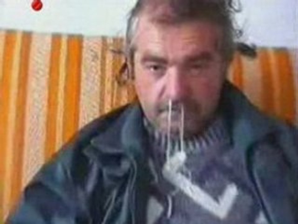 Nez qui coule