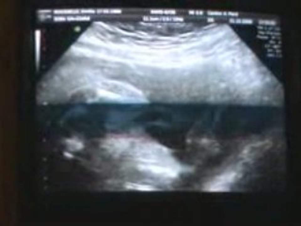 echo, 21-10-2008
