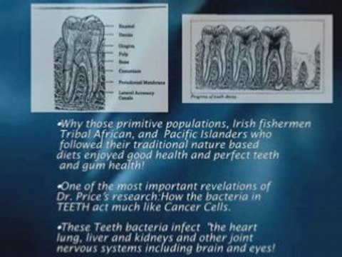 periodontal disease,gum treatment in Los Angeles
