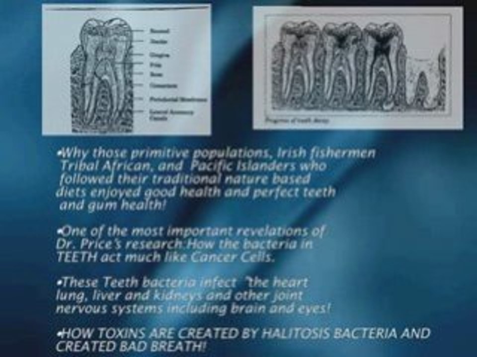 healthy gums,periodontal,dental hygiene in Los Angeles